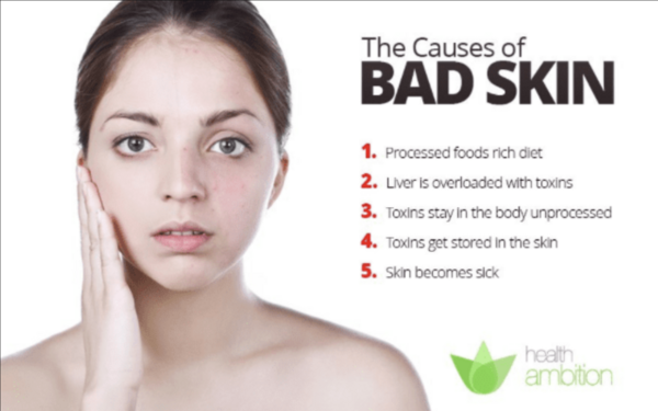 The Causes of Bad Skin